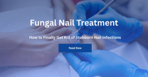 Fungal Nail Treatment